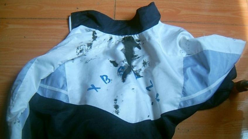衣服染上墨水了怎么去除截图2