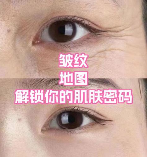 面部皮肤结构图