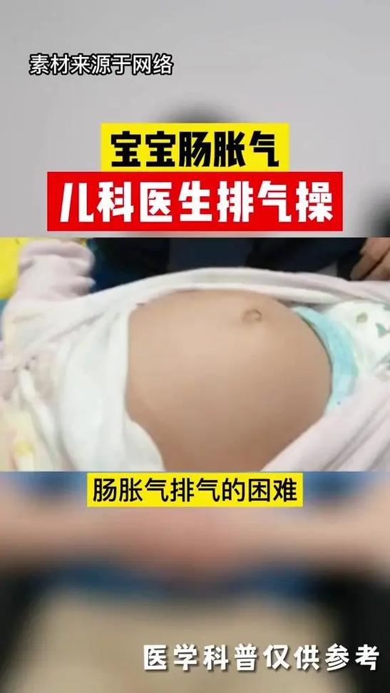 手术后胀气排气妙招