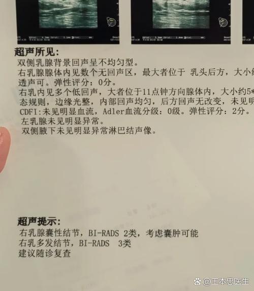 低回声包块是良性还是恶性截图2