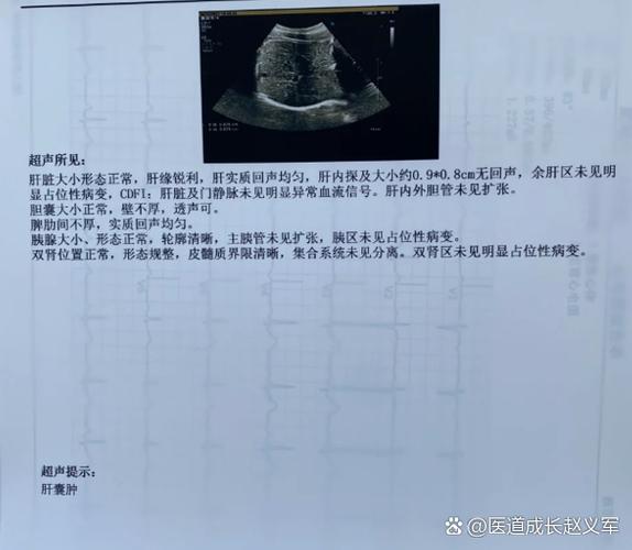 低回声包块是良性还是恶性截图3