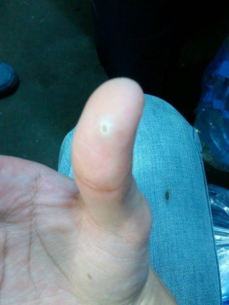 手指指纹处白色的是为什么截图1