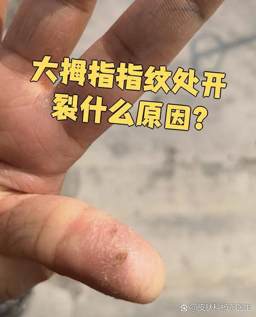 手指指纹处白色的是为什么截图2