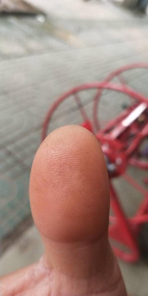 手指指纹处白色的是为什么截图3