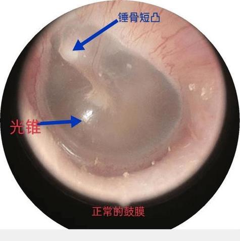 蓝牙耳机上面的黑色膜