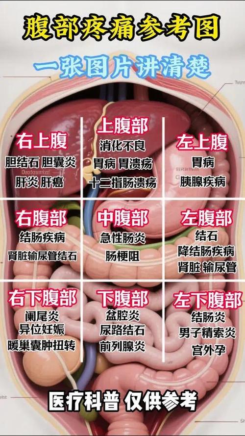 男性左侧下腹部疼痛截图2