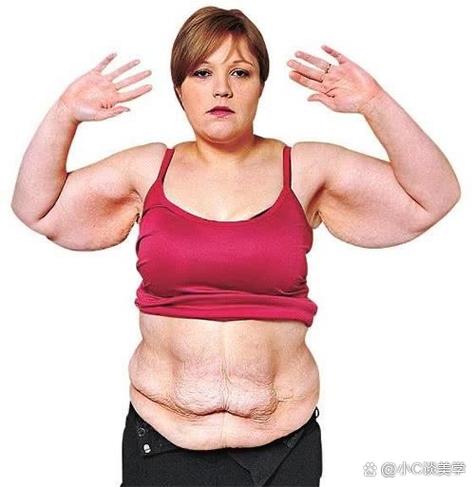 肚皮下垂松弛怎么收紧