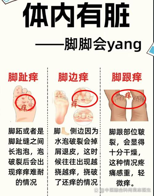 挠脚底不会痒什么原因截图3
