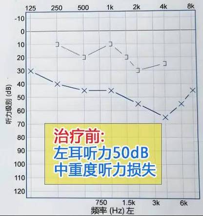 右耳朵耳鸣嗡嗡响是什么原因截图3