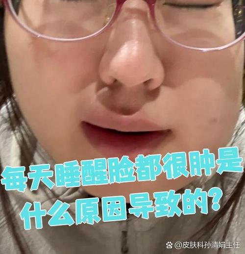 一觉醒来脸肿了是怎么回事