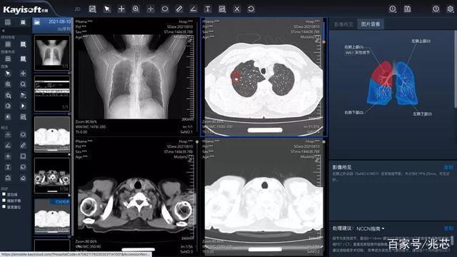 无极云影像APP