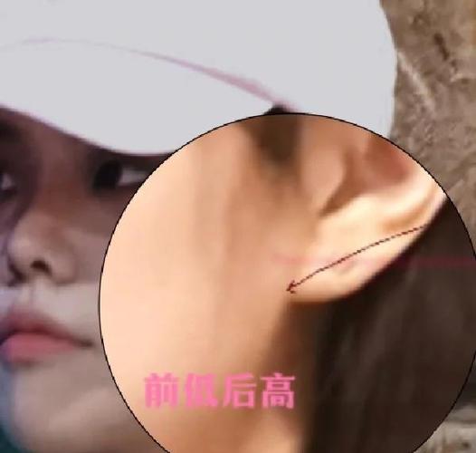耳洞会越撑越大吗