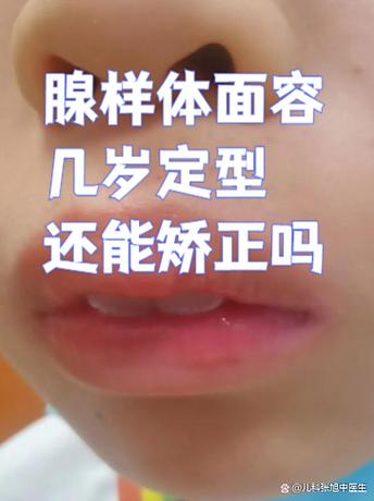 手机屏幕张嘴了怎么办截图3