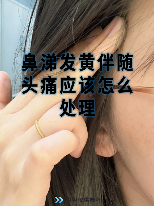 acfan流鼻血黄化截图3