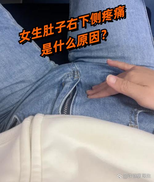 女性腹部右下侧按压痛