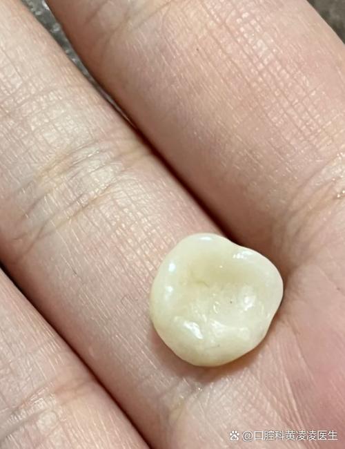 牙齿碎了一半要拔掉吗