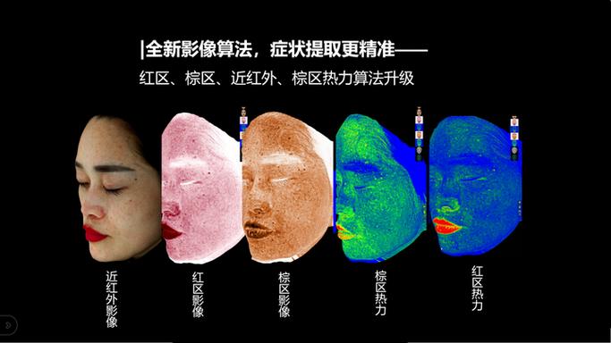 脸部皮肤检测叫什么 脸部皮肤检测叫什么