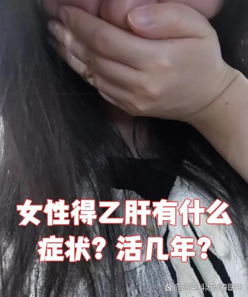 女性乙肝最明显特征 女性乙肝最明显特征
