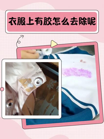 衣服上搞到胶水怎么弄掉截图3