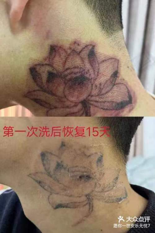 洗纹身一般多少钱一次截图3