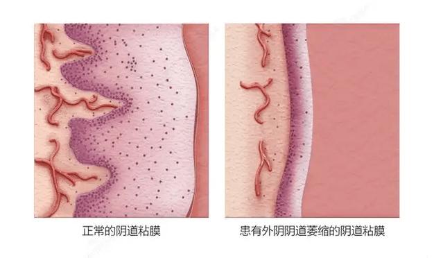 qq相册设置私密需要哪些权限