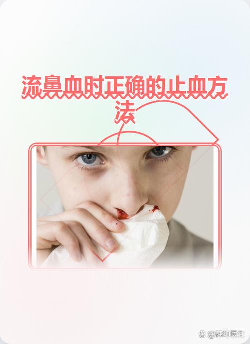 小孩流鼻血怎么处理