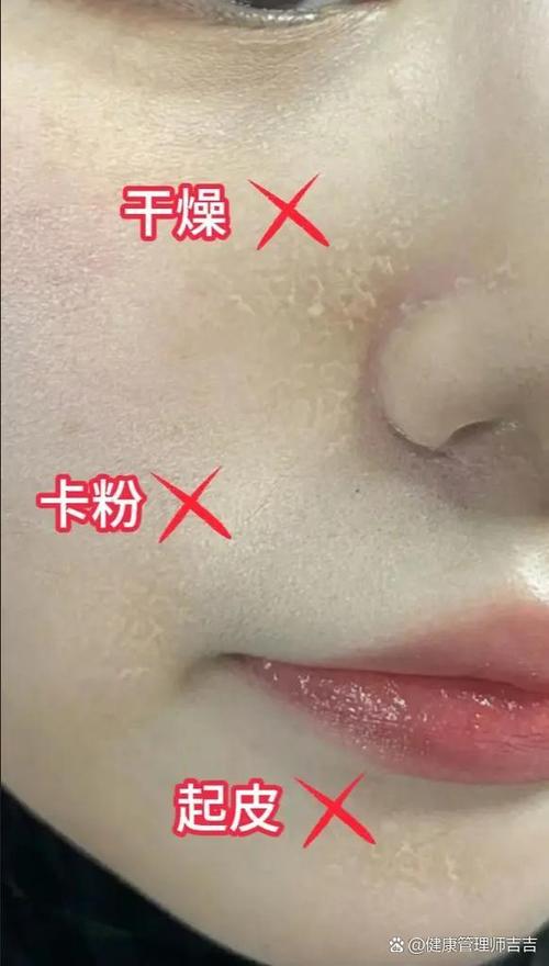 妆后卡粉怎么办