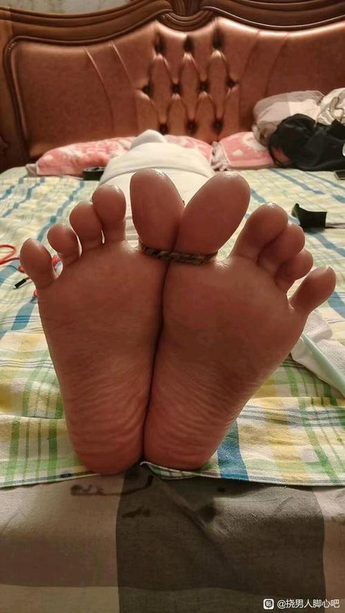 脚心痒