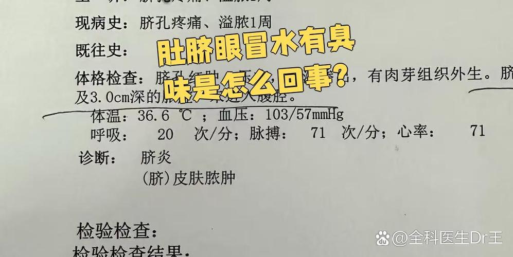 肚脐眼臭是怎么回事