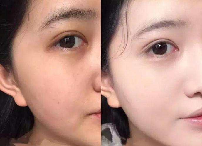 如何美白皮肤
