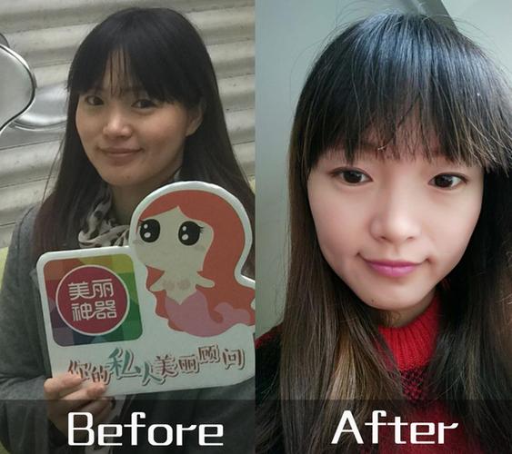 白瓷娃娃祛黄褐斑效果怎么样