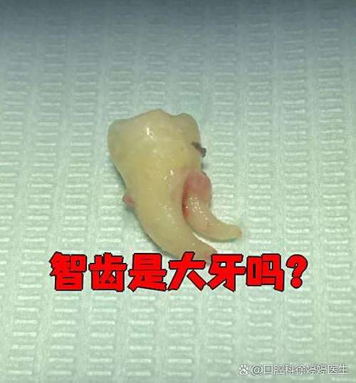 大牙里面又长了一颗牙需要拔掉吗截图3