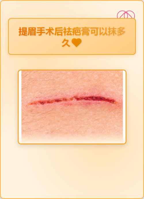 祛疤的最佳方法