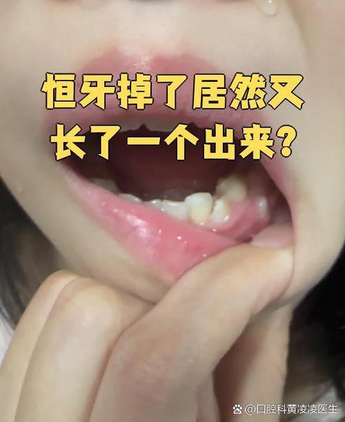 牙齿没掉里面又长一颗歪了截图2