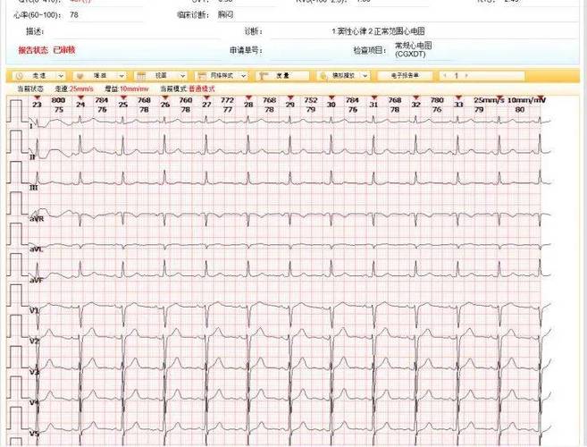 最近心脏频繁乱跳怎么回事截图2
