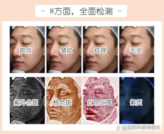 测皮肤状态 测皮肤状态