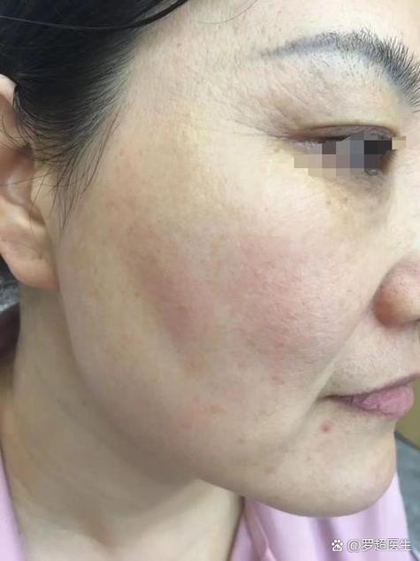 点斑大概需要多少钱截图3