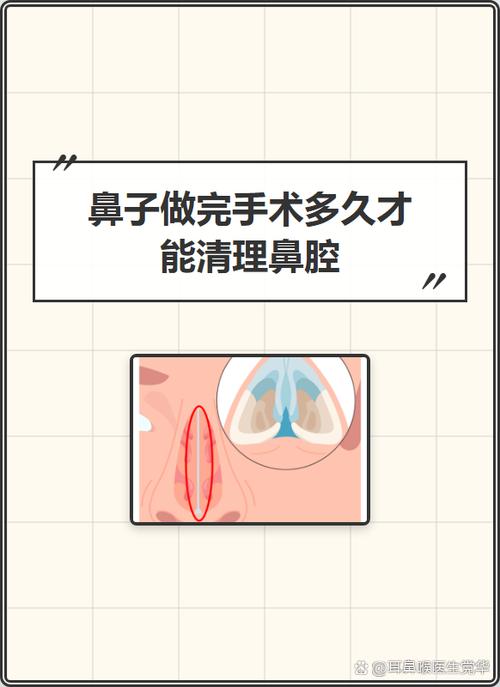 做完鼻子注意事项截图2