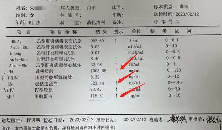 女性乙肝最明显特征截图2