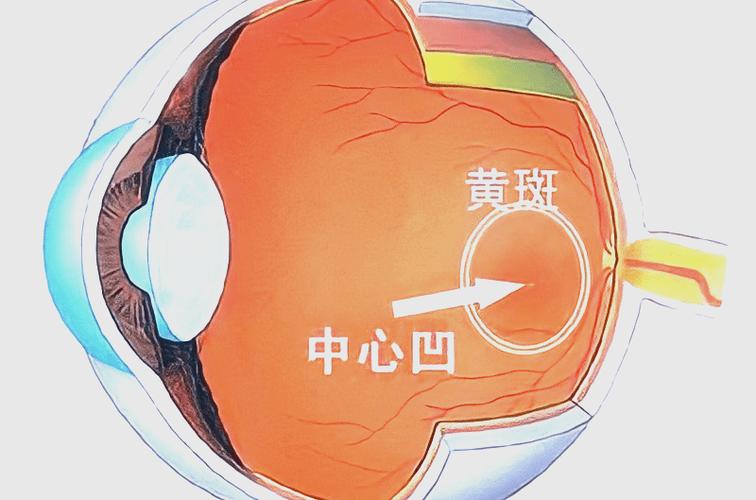 眼睛黄斑