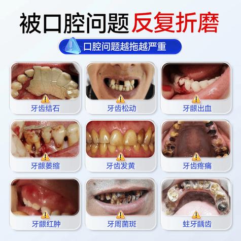 最里面的板牙掉了一半怎么搞