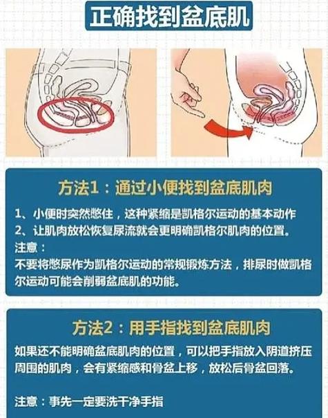 盆底肌训练器视频教程截图2