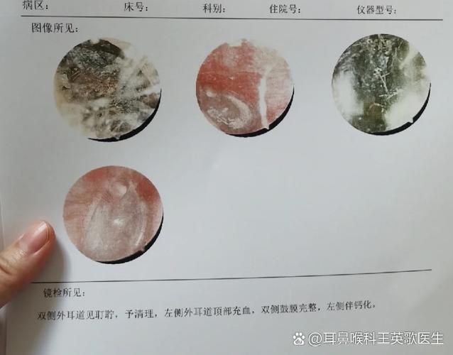 耳朵听不见声音怎么回事截图1