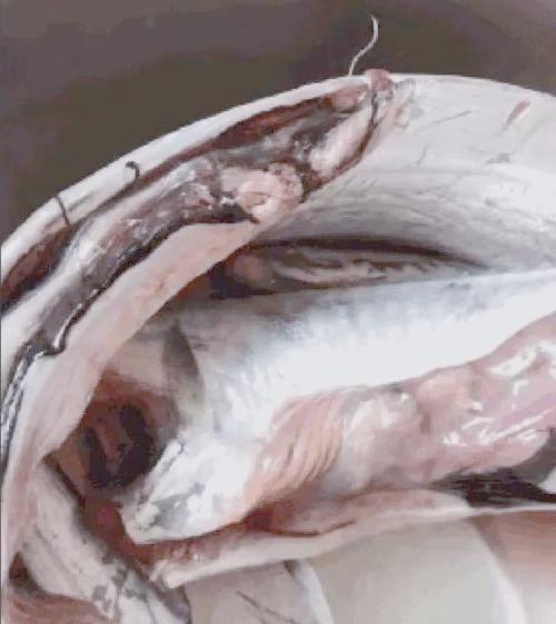 吃什么清理体内寄生虫截图2