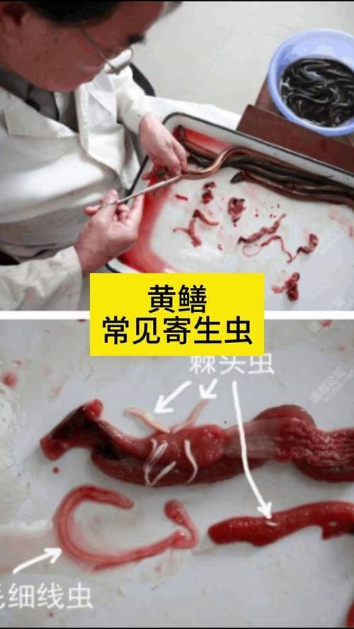寄生虫寄生