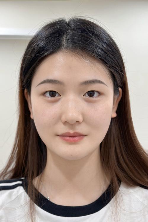 眼睛单眼皮变成内双了