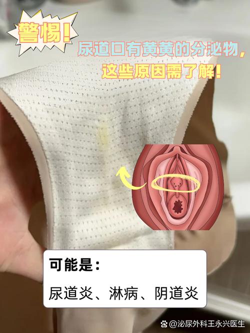100款禁用黄免费a尿道口